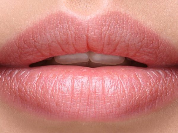 Labbra sempre secche e screpolate? I rimedi che&nbsp;consiglio